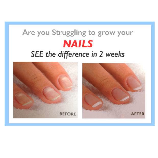 Vitry Nail repair treatment for weak nails